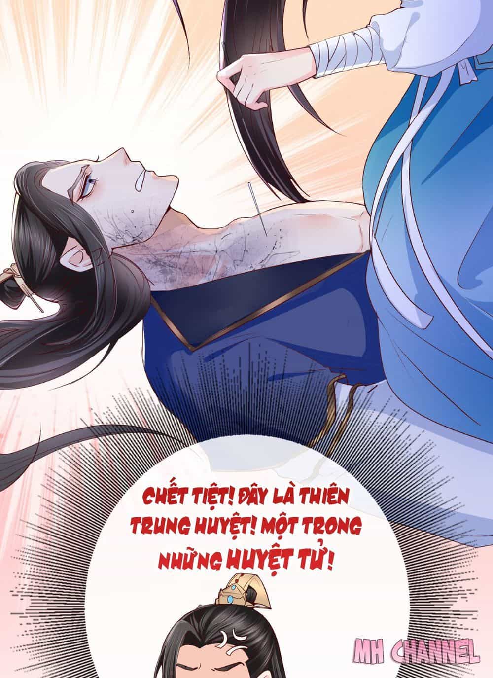 Độc Phi Ngu Ngốc Không Thể Chọc - Chương 6 - ảnh 26