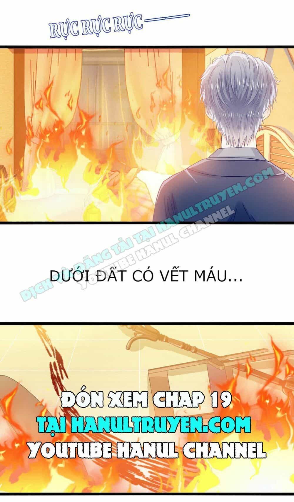 Lăng Thiếu! Nhẹ Một Chút, Đau - Chương 18 - ảnh 25