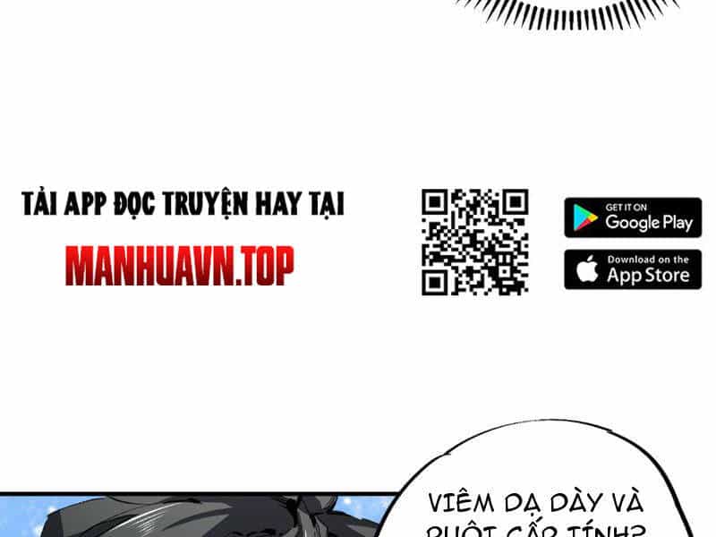 Thiên Sinh Độc Nãi, Ta Nguyền Rủa Toàn Thế Giới! - Chương 2 - ảnh 112