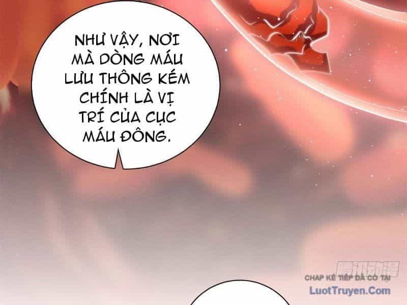 Trở Thành Vô Địch Bằng Hệ Thống Giảm Giá Trị - Chương 70 - ảnh 78